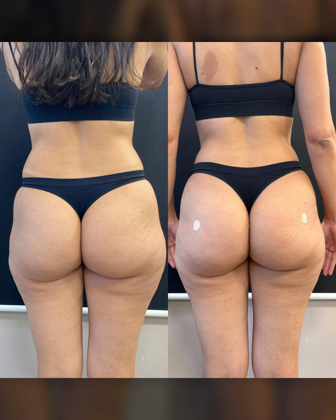 Antes e Depois1