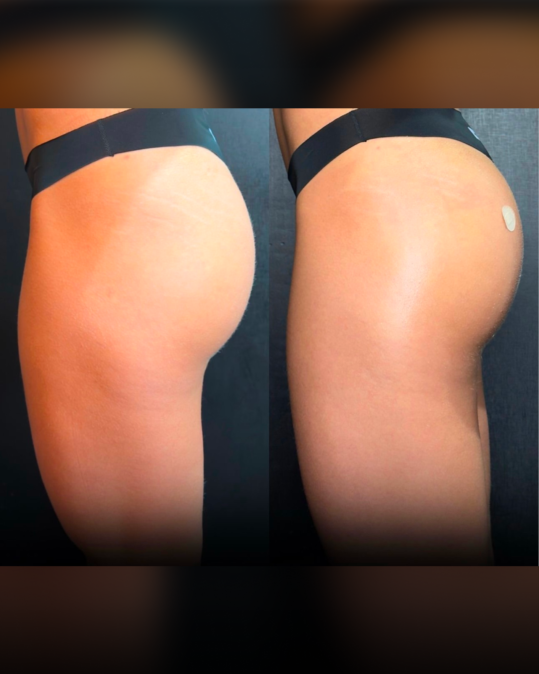 Antes e Depois2