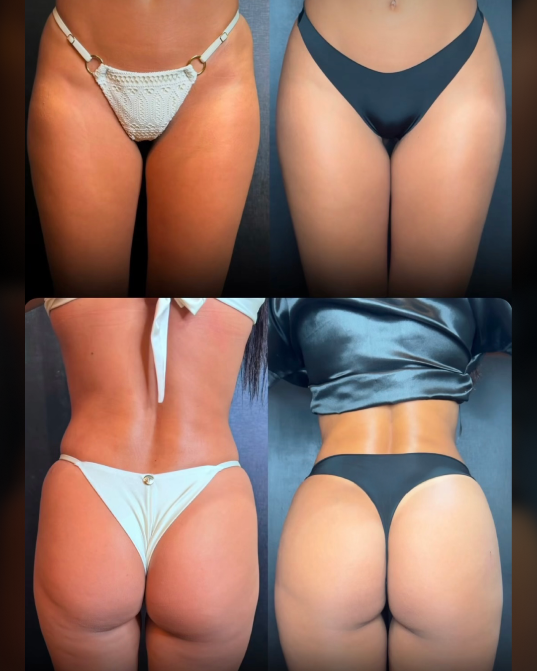 Antes e Depois4